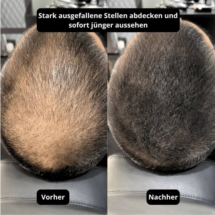 Vollum Haar-Dichte Auffüller